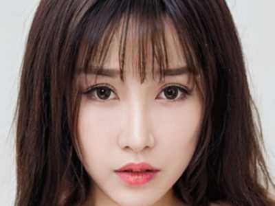 德宏牙龈高矫正整形美容适合人群和禁忌人有哪些